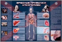 Электрифицированный стенд "Вредные привычки: алкоголизм" - «globural.ru» - Апрелевка