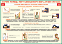 Таблица Порядок действий при опасном кровотечении 1000*1400 винил - «globural.ru» - Апрелевка