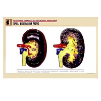 Рельефная таблица "Почка. Фронтальный разрез" (формат А1, матовое ламинир.) - «globural.ru» - Апрелевка